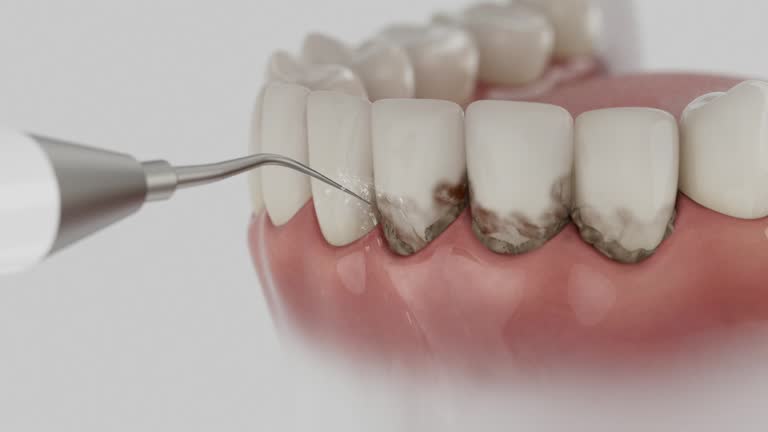 Reliable Dental contractor in Huntsville, MO by Dentist Open Now